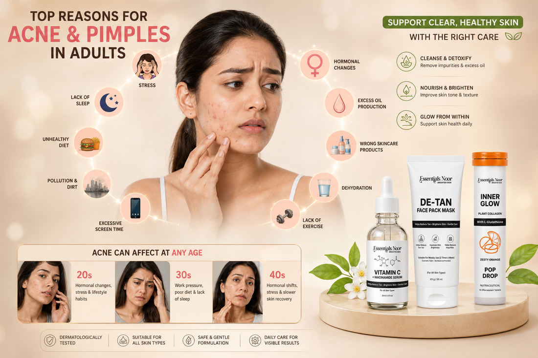 Top Reasons for Acne and Pimples in Adults
