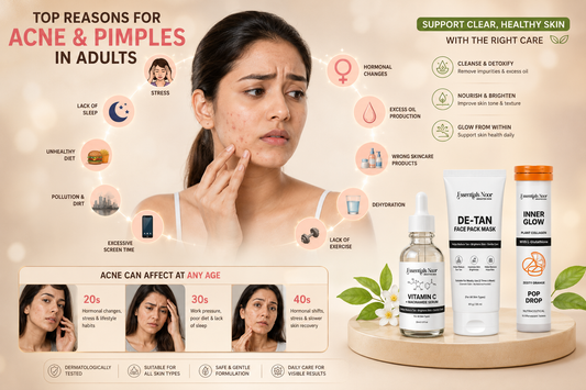 Top Reasons for Acne and Pimples in Adults