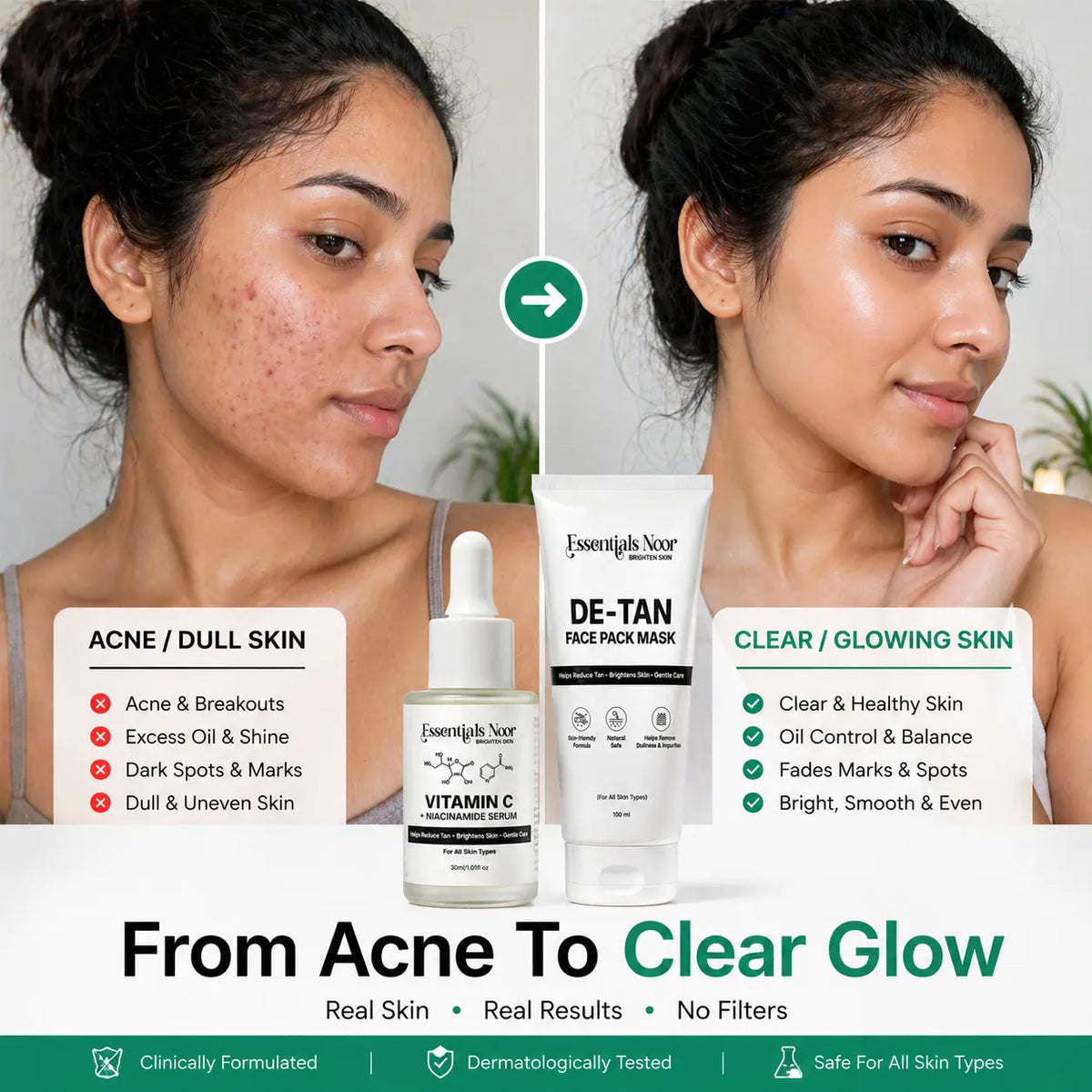 Acne Care Kit (Serum + Mask)